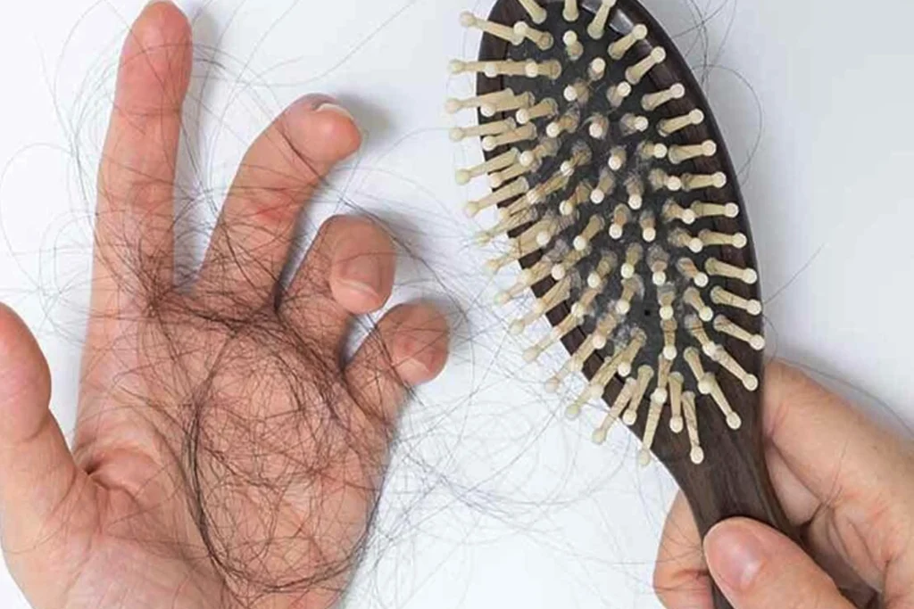 Hair Tonic Yang Bagus